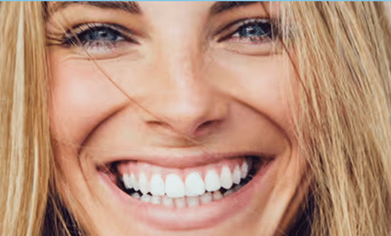 GO SMILE™ Teeth Whitening Treatment